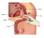 ProstateExamDiagram720WEB